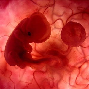 monitorización fetal